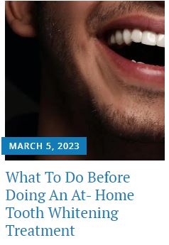 What To Do Before Doing An At- Home Tooth Whitening Treatment